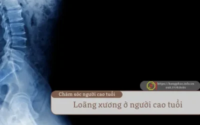 Loãng Xương Ở Người Cao Tuổi: Dấu Hiệu, Nguyên Nhân Và Cách Phòng Tránh